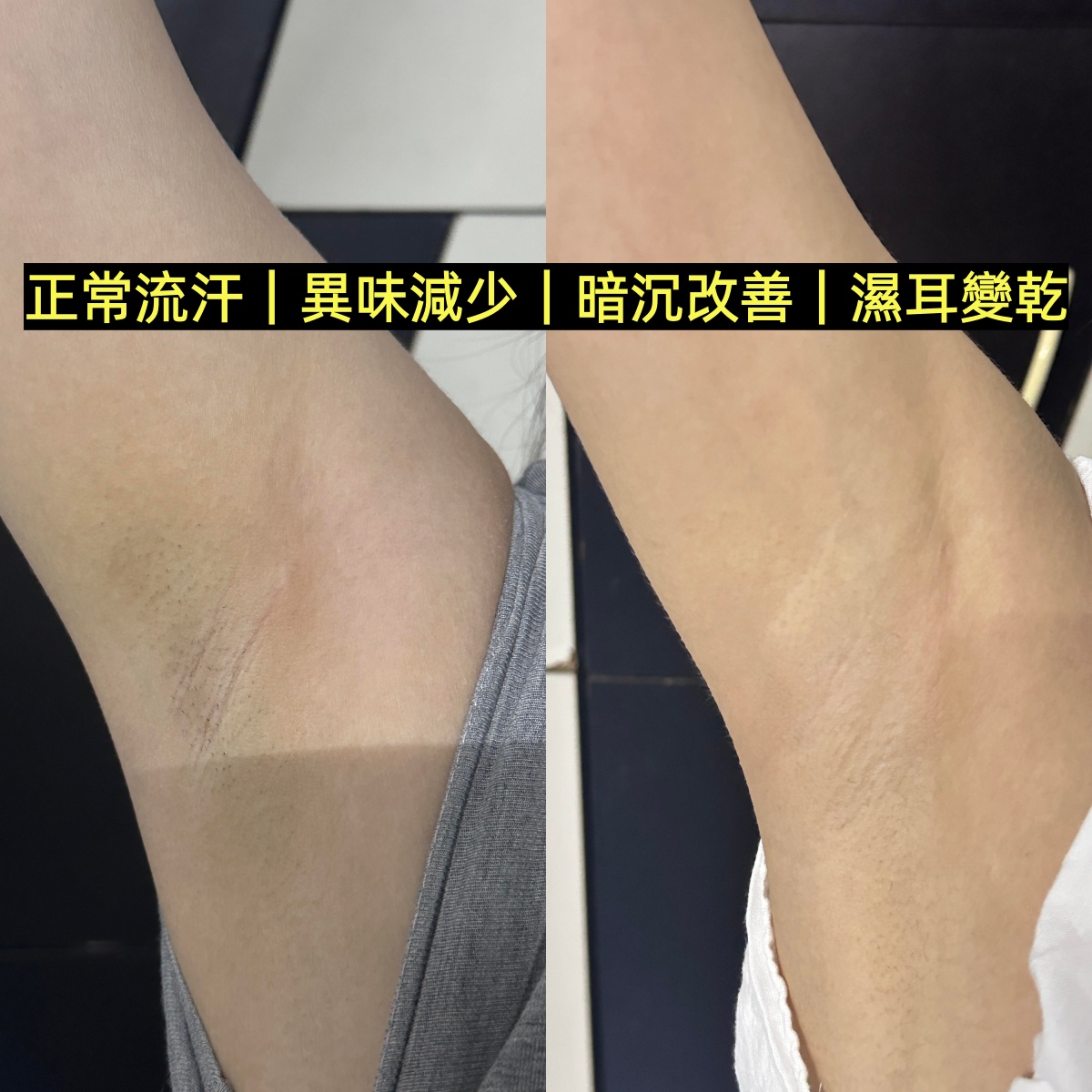 腋下狀態參考